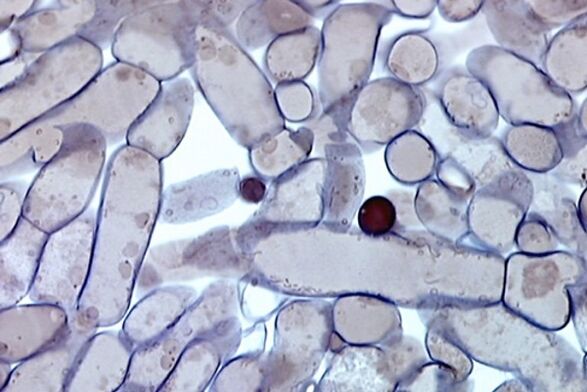 клетки от гъбички по ноктите под микроскоп