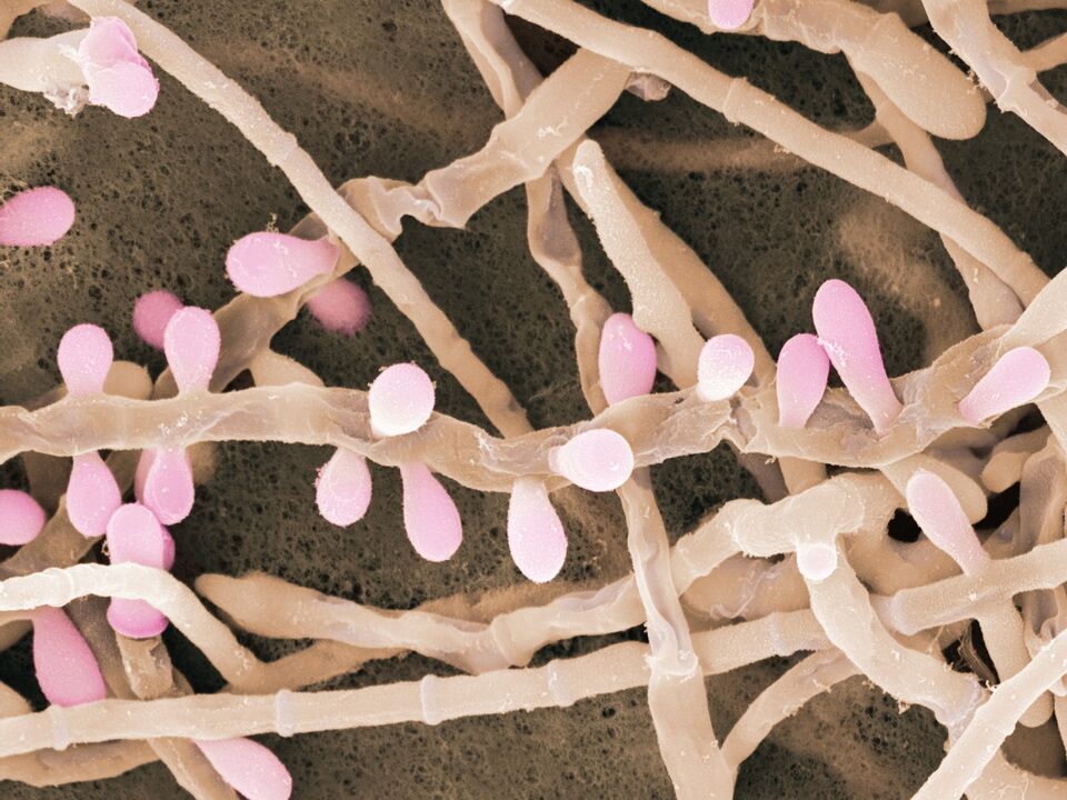 Trichophyton rubrum е вид гъбички, които засягат кожата на краката.